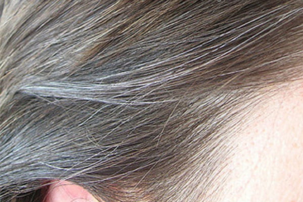 Remedies for premature grey hair