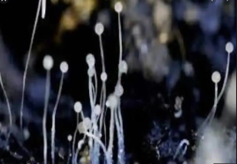 Black Fungus: ఏపిలో బ్లాక్ ఫంగస్‌కు ట్రీట్మెంట్ చేసే హాస్పటల్స్‌ ఇవే..!!