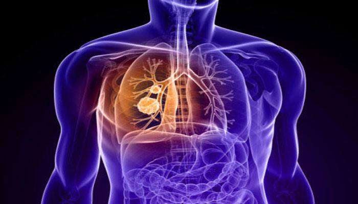 Lungs: problems to check this ayurvedic Remedie