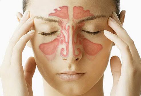 Sinus Breathing Problems: To Check the ayurvedic medicine