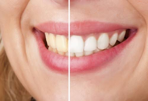 Ayurvedic Tooth Powder: To Check all Dental problems