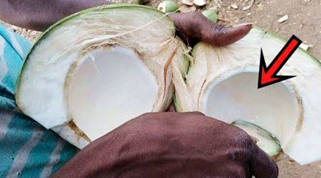 Coconut: water health benefits