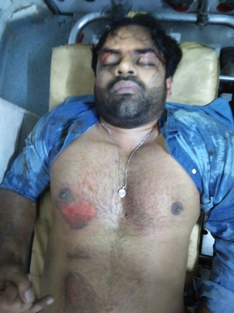 Actor Sai dharam tej injured in road accident 