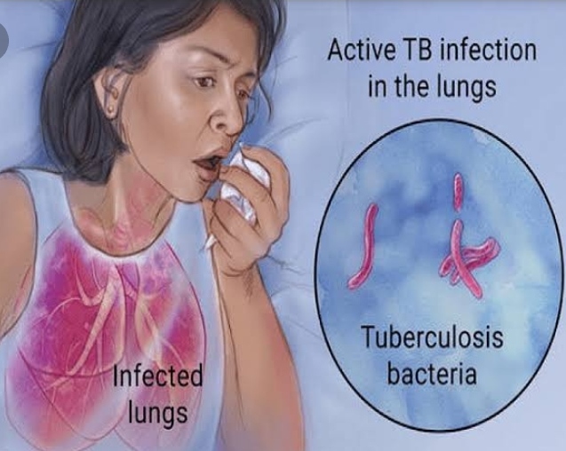 Tuberculosis: To Check this Food and juices 