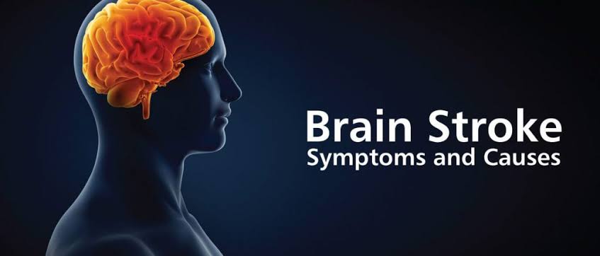 Before Attacking Brain Stroke: Symptoms and causes