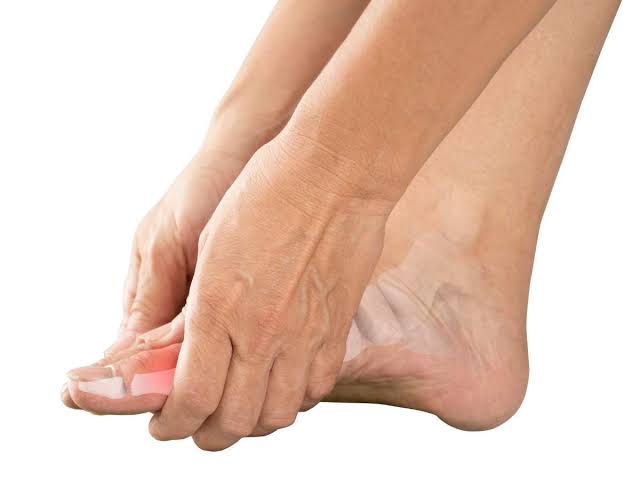 Suffering from Gout: problems don't eat these foods