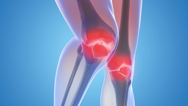 Types of Arthritis: and take this precautions