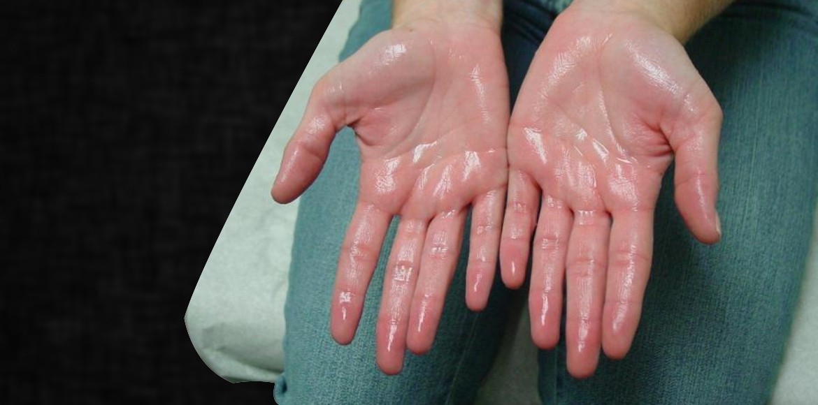 Sweaty Hands: Indicates this health problems