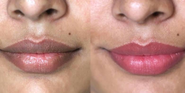 Black Lips: vs Red Lips