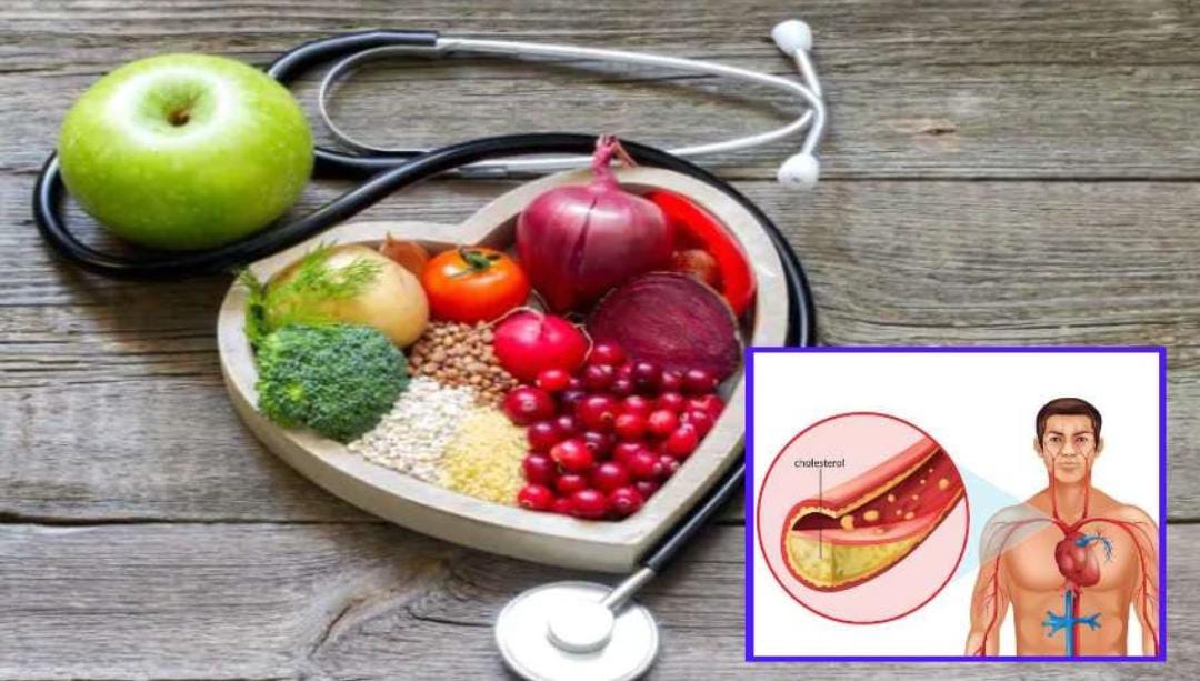 If you have these symptoms, it means that you have bad cholesterol in your body ..!