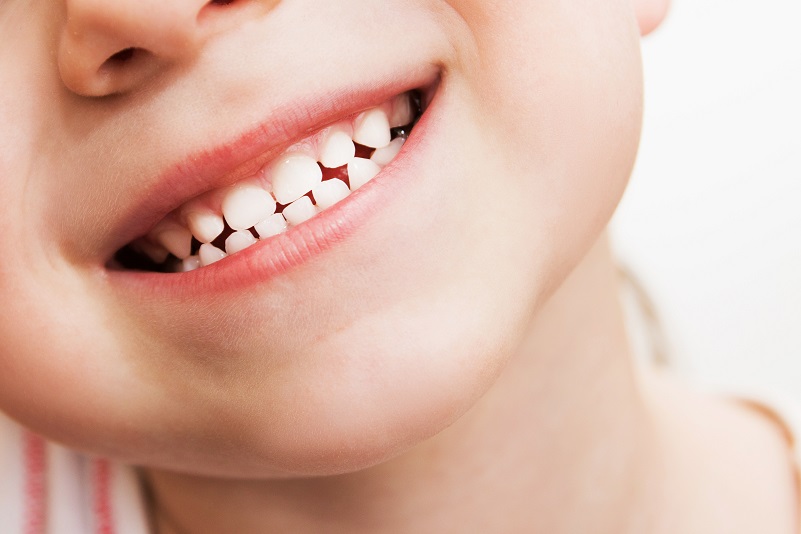 Kids: Teeth Problems Avoid These foods