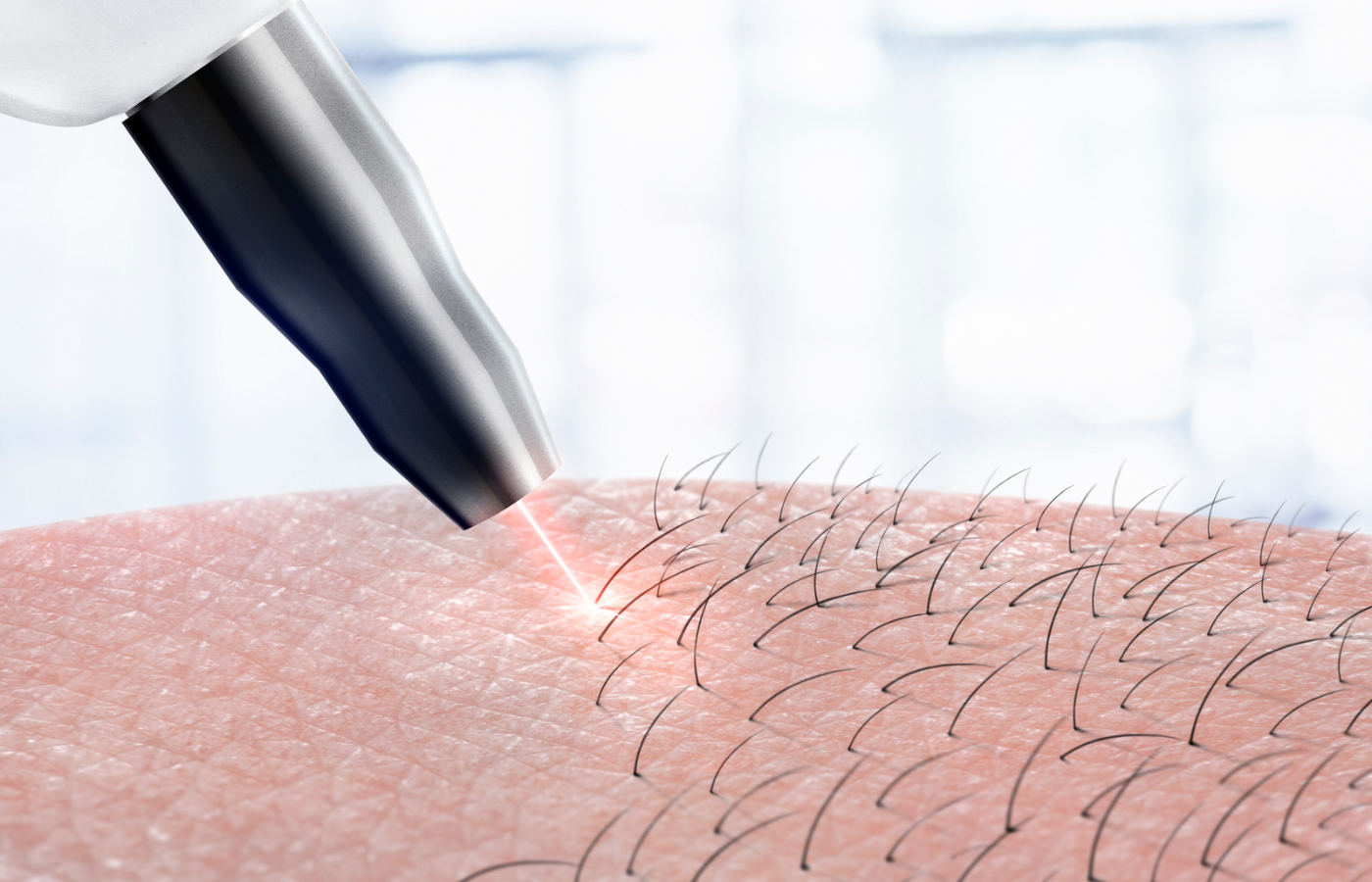 Laser Hair Removal Good or Bad